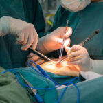Surgeons in sterile green gowns performing an operation with scalpels and forceps at the patient’s incision site.