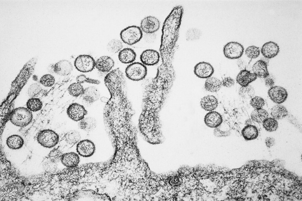 Black-and-white micrograph showing many round cells clustered around ribbon-like filaments on a rough surface, resembling microscopic bacteria on a textured substrate.