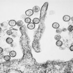 Black-and-white micrograph showing many round cells clustered around ribbon-like filaments on a rough surface, resembling microscopic bacteria on a textured substrate.