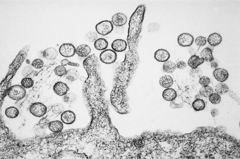Black-and-white micrograph showing many round cells clustered around ribbon-like filaments on a rough surface, resembling microscopic bacteria on a textured substrate.