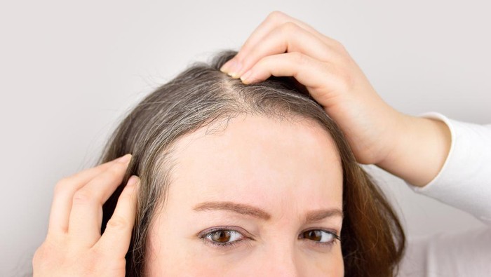 Woman lifting hair to reveal thinning scalp at the crown area