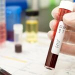 Gloved hand holding a blood sample tube labeled HIV in a laboratory, with other lab equipment blurred in the background.