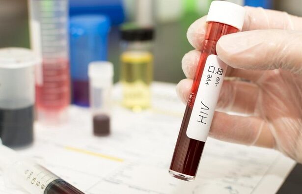 Gloved hand holding a blood sample tube labeled HIV in a laboratory, with other lab equipment blurred in the background.