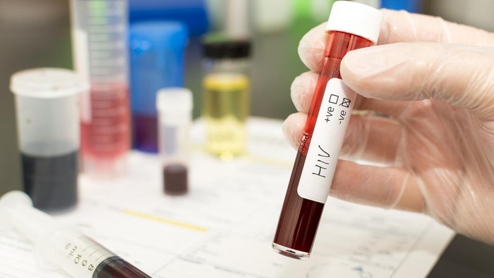 Gloved hand holding a blood sample tube labeled HIV in a laboratory, with other lab equipment blurred in the background.